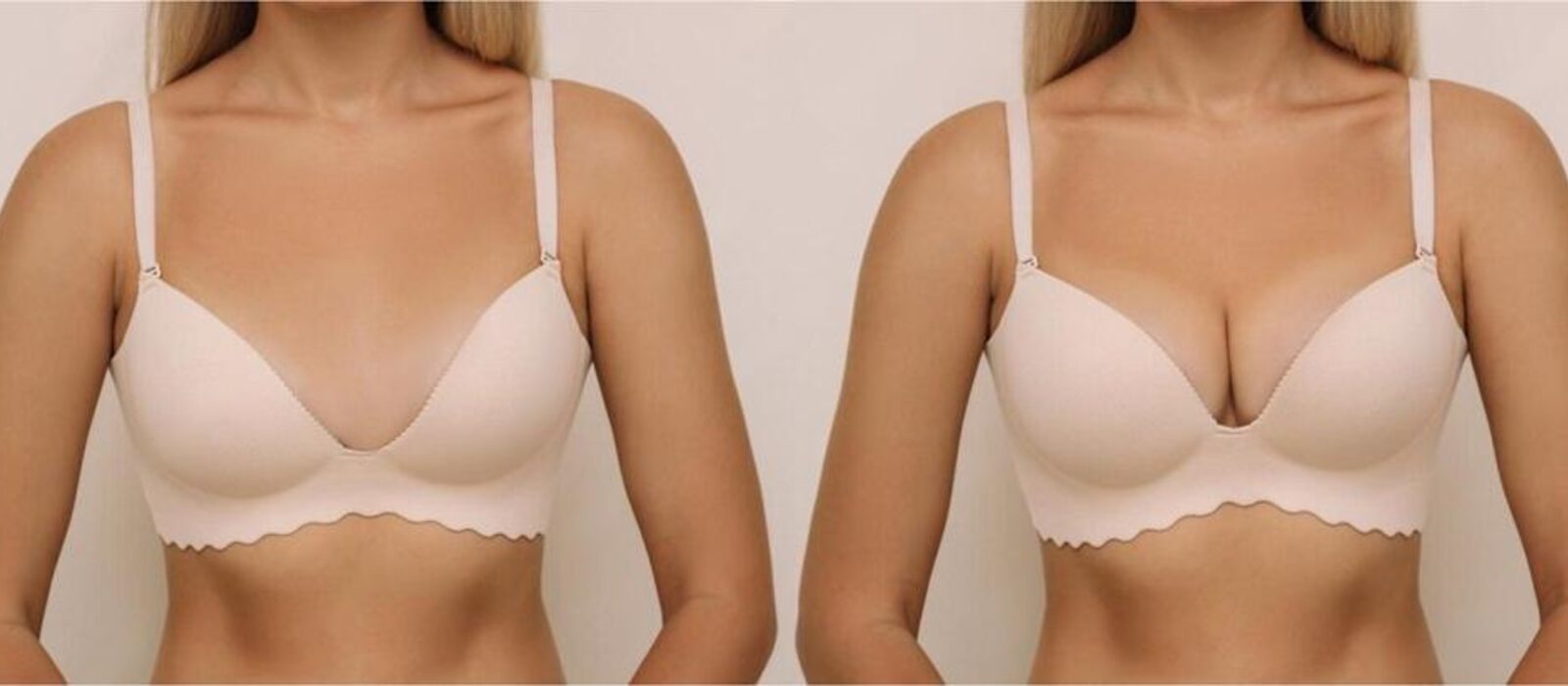 Breast Lift & Reshaping in Delhi - MS Skin & Hair Clinic Delhi