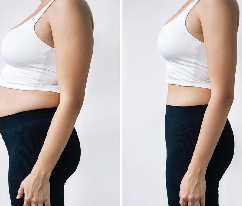 Weight loss IV drip therapy Delhi